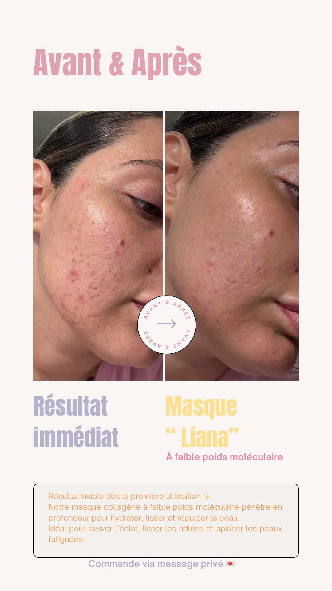 1 masque au collagène