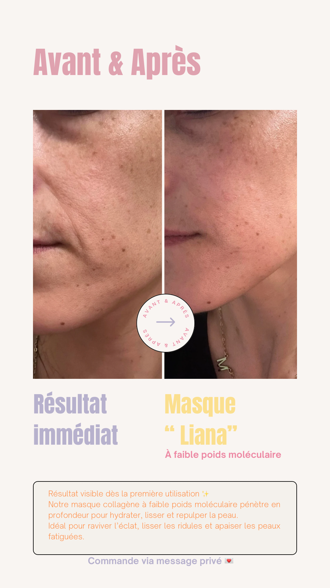 1 masque au collagène